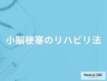 「小脳梗塞のリハビリ法」はご存知ですか？医師が徹底解説！