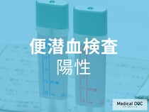 見逃せない“陽性”反応! 「便潜血検査」が示す陽性とはどういうこと? 【医師が解説】