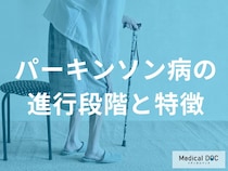「パーキンソン病」はどのように進行するのかご存じですか？ 「姿勢」や「歩き方」で進行度がわかる？