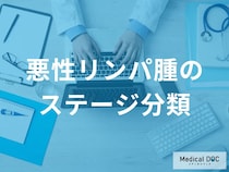 「悪性リンパ腫のステージごとの症状」はご存じですか？【医師監修】