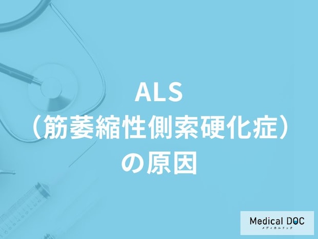 「ALS（筋萎縮性側索硬化症）の3つの原因」はご存知ですか？【医師監修】