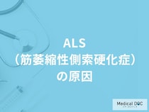 「ALS（筋萎縮性側索硬化症）の3つの原因」はご存知ですか？【医師監修】