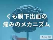 「くも膜下出血の痛みの特徴」をご存じですか？ 知っておきたいサインを医師に聞く