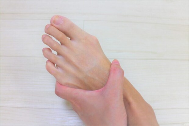 外反母趾のケア