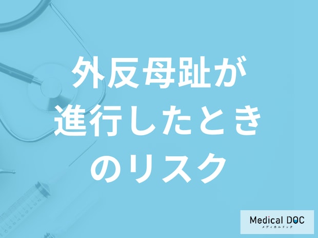 「外反母趾が進行」すると何ができなくなるかご存じですか?予防法を医師が解説！