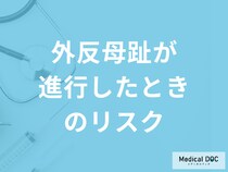 「外反母趾が進行」すると何ができなくなるかご存じですか?予防法を医師が解説！