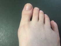 外反母趾にならないハイヒールの選び方ってあるの？