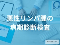 「悪性リンパ腫」はどのようにして診断されるのか？検査法を解説！【医師監修】