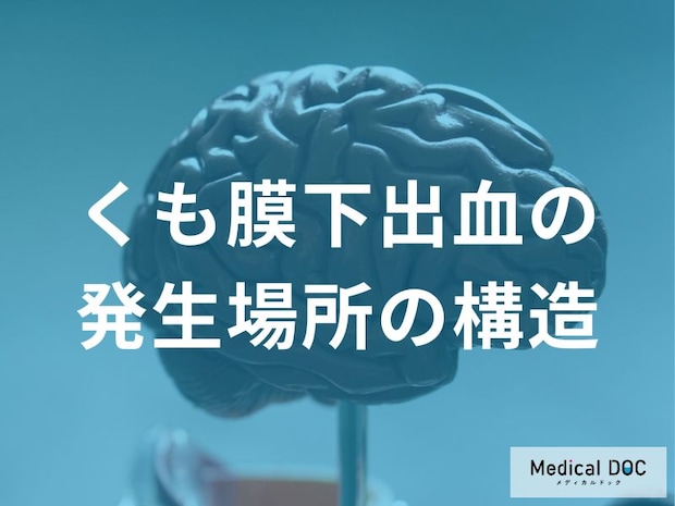 「くも膜下出血」の前兆を見逃さないために…発生部位を知る重要性とは【医師監修】