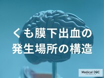 「くも膜下出血」の前兆を見逃さないために…発生部位を知る重要性とは【医師監修】