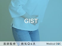 「GIST」とは？がんとの違い・症状・治療法も併せて解説！【医師監修】