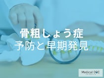 知ってほしい! 骨が脆くなる「骨粗しょう症」治療よりも大事なのは予防と早期発見【医師が解説】