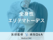 「全身性エリテマトーデス（SLE）（指定難病49）」の初期症状はご存知ですか？