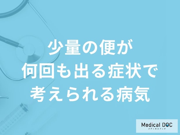 「少量の便が何回も出る」のは「大腸がん」や「便秘」を疑った方がいい?【医師解説】