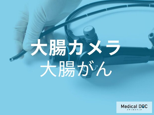 早期発見が“命を救う”! 「大腸カメラ」で大腸がんを早期発見することの重要性【医師が解説】