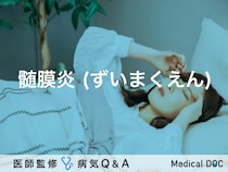 「髄膜炎」とは？症状・原因・検査についても解説！【医師監修】
