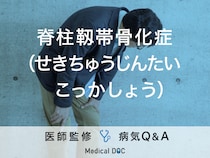【医師監修】背筋や首の違和感には要注意！「脊柱靱帯骨化症」とは？