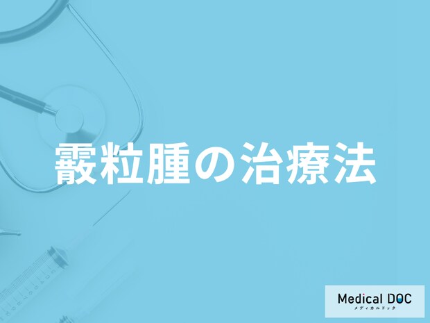 まぶたが腫れる「霰粒腫の効果的な治療法」はご存じですか？予防法も解説！