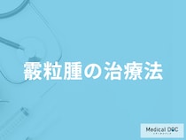 まぶたが腫れる「霰粒腫の効果的な治療法」はご存じですか？予防法も解説！
