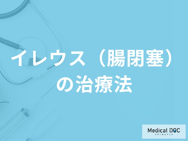 「イレウス（腸閉塞）の治療法」はご存じですか？治療中の注意点も医師が解説！