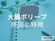 症状がなくても安心できない! 大腸がんの前触れとなる「大腸ポリープ」の原因と特徴【医師が解説】