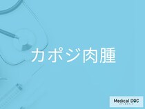 「カポジ肉腫」の初期サインは“紫の発疹”だけ？ 見逃されやすい全身症状を医師に聞く