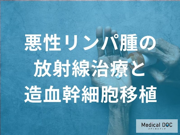 「悪性リンパ腫に放射線治療・造血幹細胞移植」はどんな効果があるのか？【医師監修】
