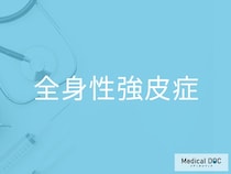 「全身性強皮症」の前兆をご存じですか？ “指が白くなる”危険な理由を医師が解説
