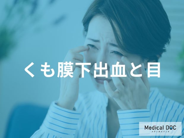 「くも膜下出血」を発症すると「目」にどんな症状が現れるかご存知ですか？【医師解説】