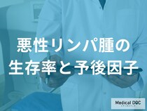 「悪性リンパ腫の生存率」はどのくらいかご存じですか？予後も医師が解説！