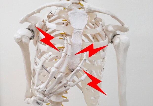 フレイルチェスト