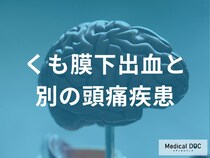 「くも膜下出血」と「片頭痛」の決定的な違いを医師が解説 “突然の激痛”は要注意