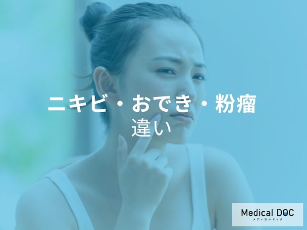 「ニキビ」「おでき」「粉瘤」の違いをご存知ですか? 特徴と見分け方を医師に聞く