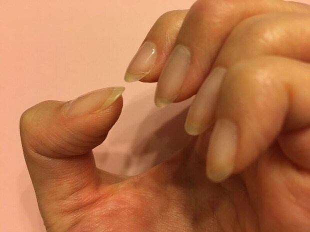 ひびが入った爪