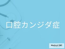 “舌の白い苔”は病気のサイン？ 実は「口腔カンジダ症」の可能性も【医師監修】