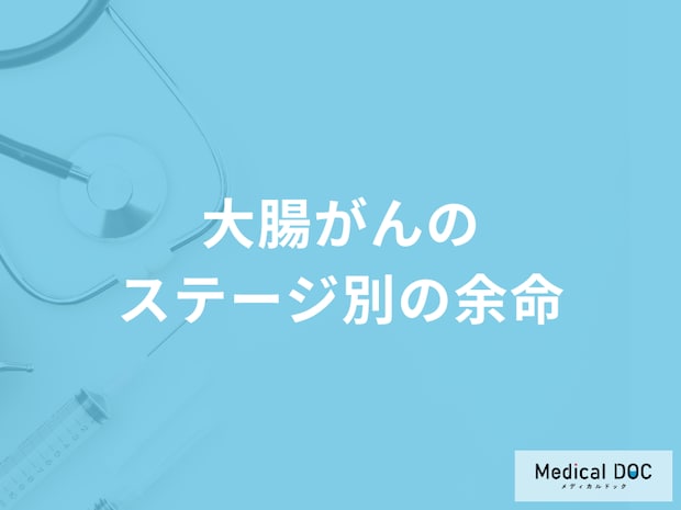 「大腸がんのステージ別の余命」はご存知ですか？医師が徹底解説！