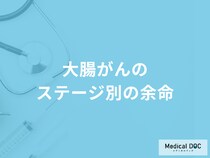 「大腸がんのステージ別の余命」はご存知ですか？医師が徹底解説！