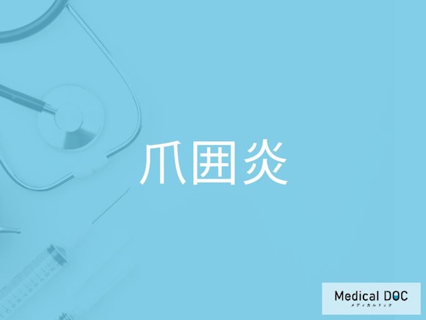 ”爪の赤みや腫れ”は「爪囲炎」のサイン？ 日常生活でできる予防策を医師が解説