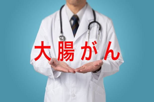 家族に大腸がん患者がいるとリスクはどのくらい上がる？