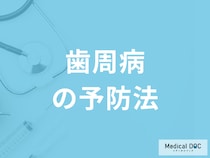 「歯周病の予防法」はご存知ですか？受診の目安となる症状も医師が解説！