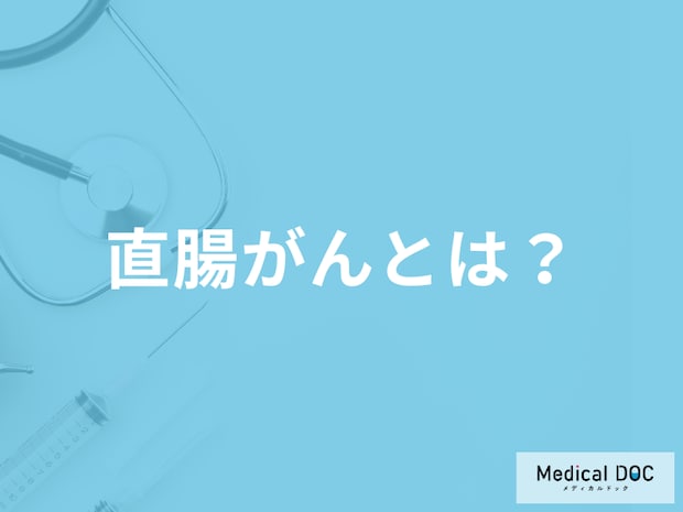「直腸がん」を発症するとどこに痛みを感じる？よくある質問を医師が徹底解説！