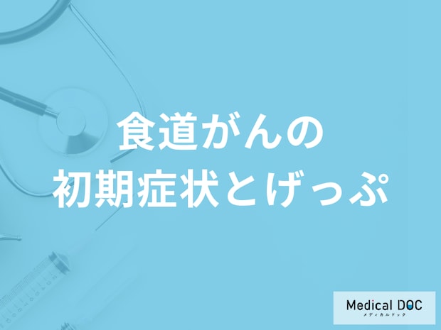 『げっぷが続く』のは「食道がんの初期症状」？進行すると現れる症状も医師が解説！