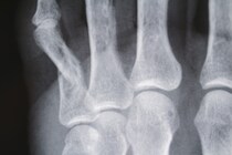 「ビールに用いられるホップが骨粗しょう症予防に効果的」このウワサを医学的な視点から解説