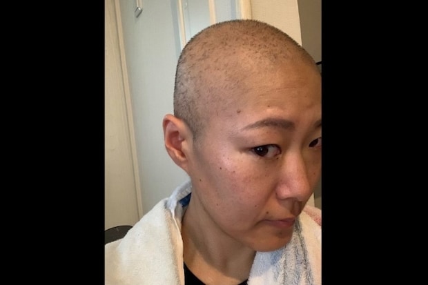 さまざまな治療の選択肢から選んだ治療方法は