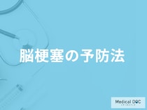 「脳梗塞」は発症して何時間以内に治療すれば『後遺症が残りづらい』？予防法も解説！