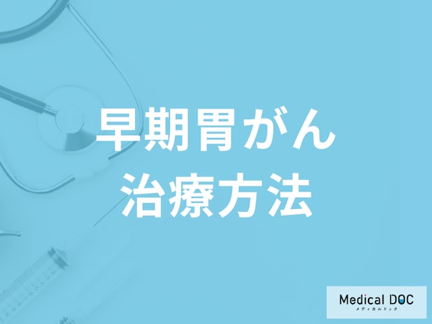 「胃がん」は一週間で治療可能!? 早期の胃がんの治療方法を医師に聞く