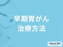「胃がん」は一週間で治療可能!? 早期の胃がんの治療方法を医師に聞く