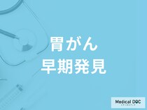 初期の「胃がん」は一週間で治療が終わる! 早期発見のコツを医師に聞く