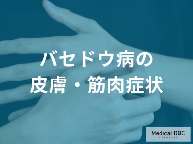 バセドウ病の身体変化とは？皮膚の湿潤や痒み、階段がつらい筋力低下などの症状