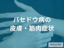 バセドウ病の身体変化とは？皮膚の湿潤や痒み、階段がつらい筋力低下などの症状